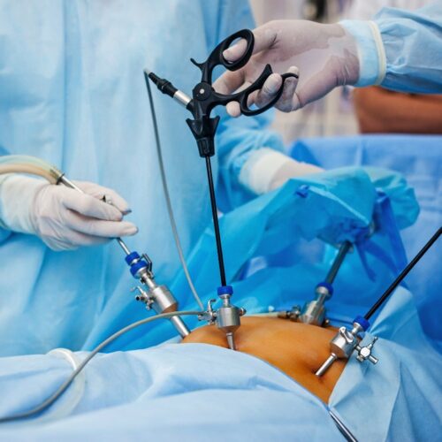 Considering Minimally Invasive Gynecologic Surgery.